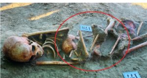 ஒன்றையொன்று கட்டியணைத்தவாறு மீண்டும் ஒரு எலும்பு கூட்டுத் தொகுதி மீட்பு