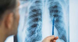 நாட்டில் வருடாந்தம் 9,500 வரை காசநோயாளர்கள் அடையாளம்